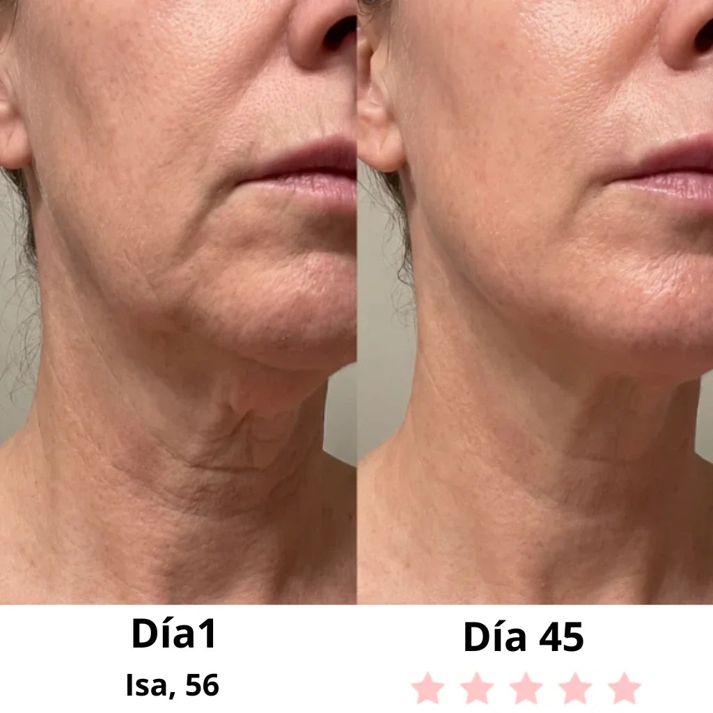 Velora-Masajeador Facial Eléctrico