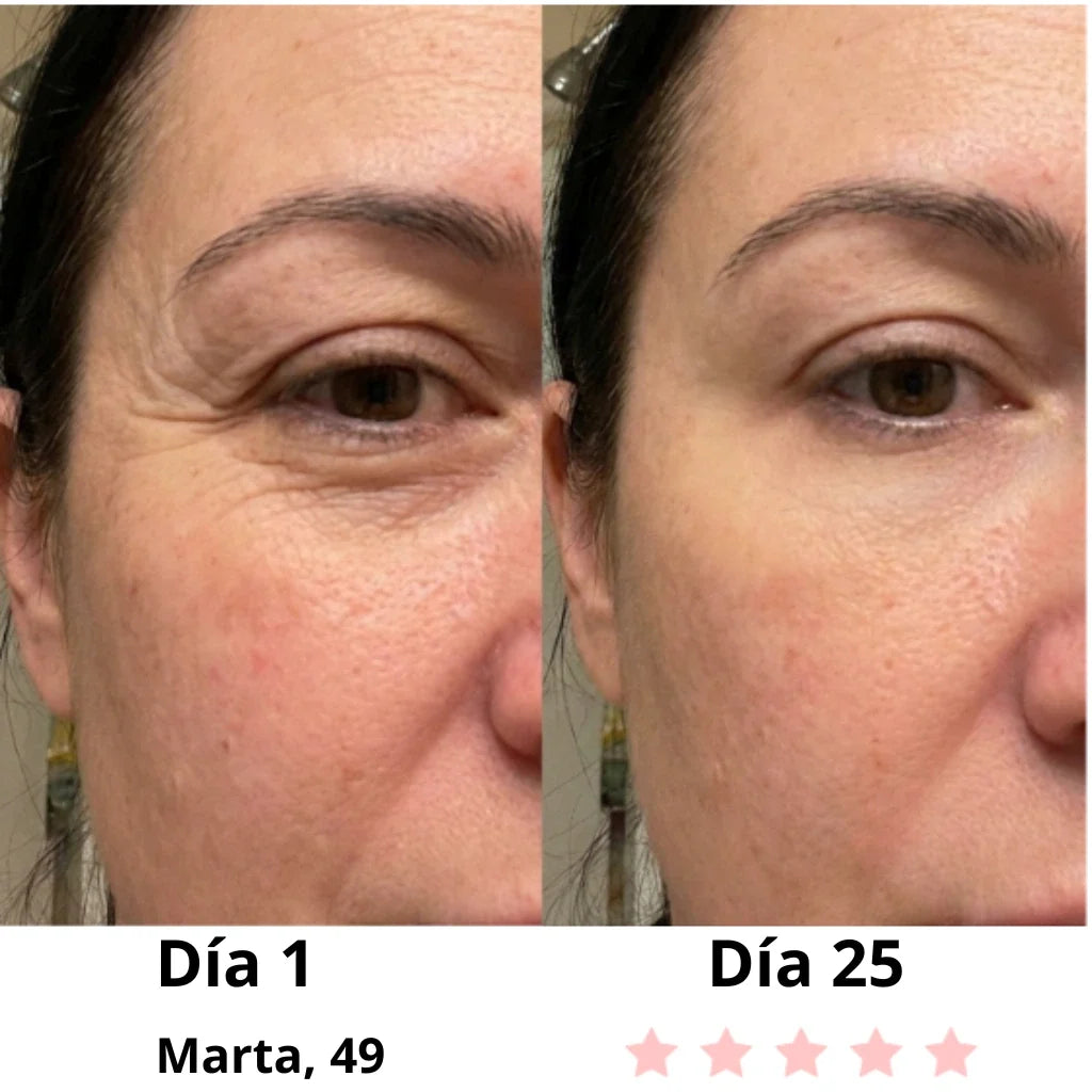 Velora-Masajeador Facial Eléctrico